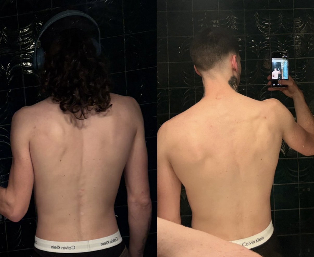 Antes y después: definición y ganancia muscular; evolución de espalda · mismo proceso